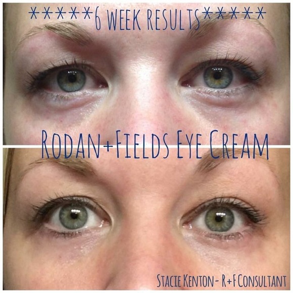 rodan fields eye serum