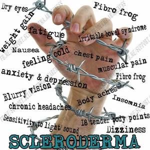 Meet your Posher, Jesenia