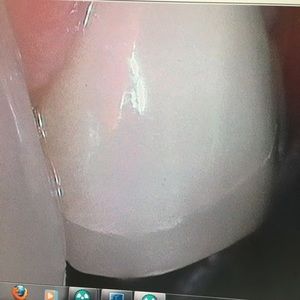 Meet your Posher, Fernando