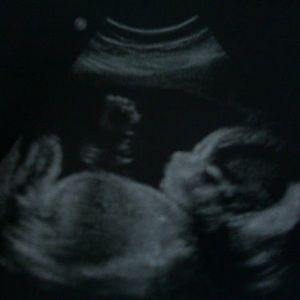 Meet your Posher, Precious