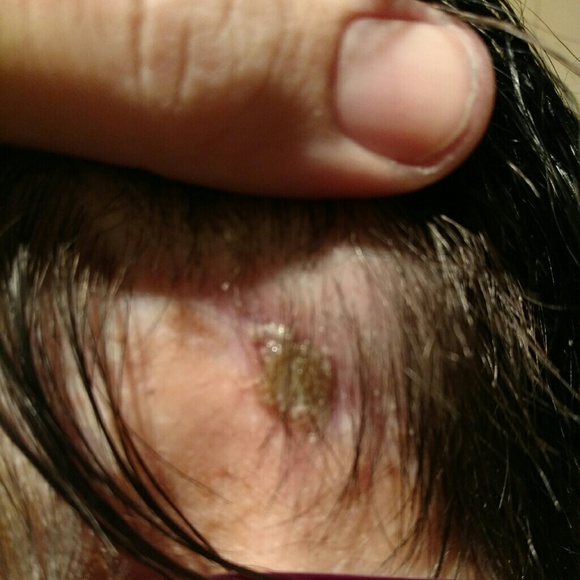 Just got out of the hospital... - Picture 2 of 2