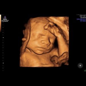 Meet your Posher, Danny