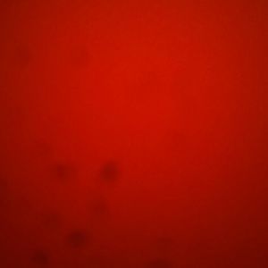 Meet your Posher, Angel