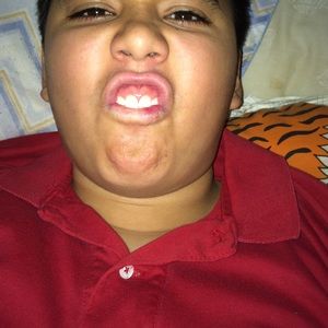 Meet your Posher, Frankie