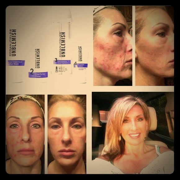 Skin care