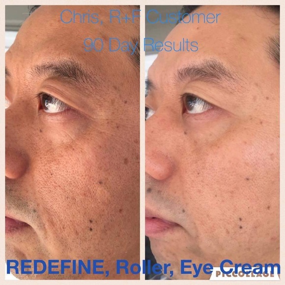 Skin care