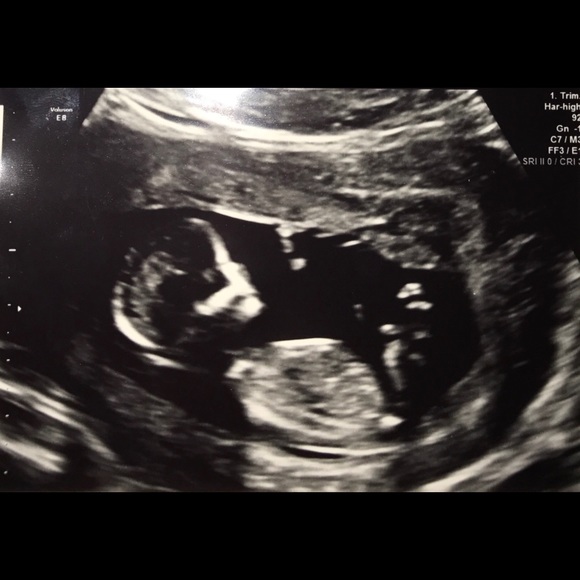 Meet your Posher, Eileen - Picture 1 of 1