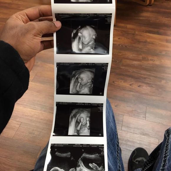 Meet your Posher, Erich