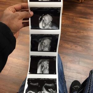 Meet your Posher, Erich