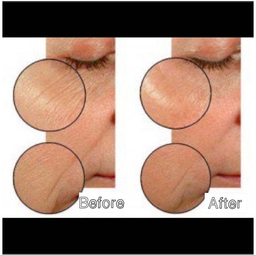 1 Combo/Oily left! Mary Kay TimeWiseMiracle Set - Picture 2 of 4