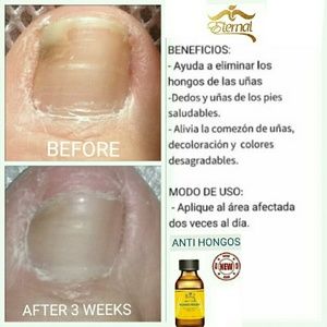 Feet Care