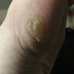 Meet your Posher, Kimp