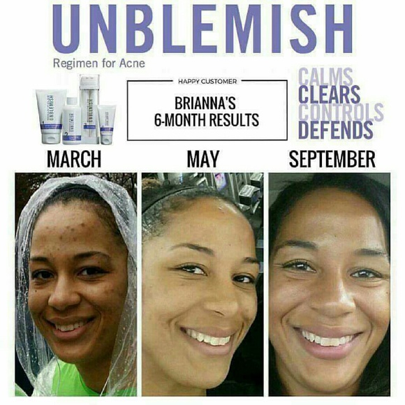 Rodan+Fields Unblemish for acne/acne scars - Picture 4 of 4