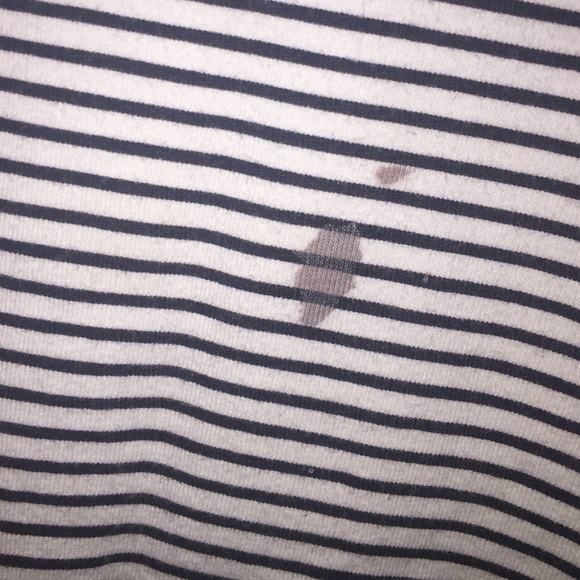 Striped Cross-Back Dress - Picture 3 of 4