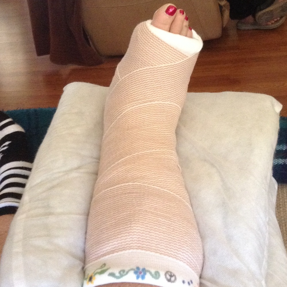🤕BROKEN LEG SALE🤕