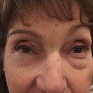 Hydrogel eye patches. No more Puffy, wrinkled eyes