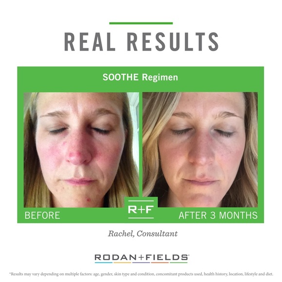 Rodan + Fields Soothe - Picture 3 of 4