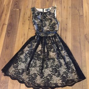 Scalloped Hem Lace Dress