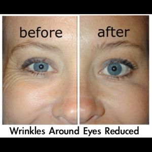 mary kay firming eye cream before and after