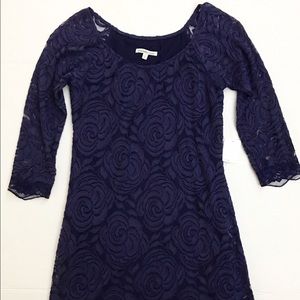 ‼️‼️**NEW** Lace Dress