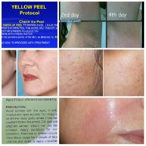FREE Yellow peeling oil