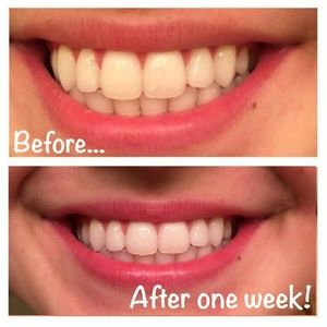 Ap 24 toothpaste