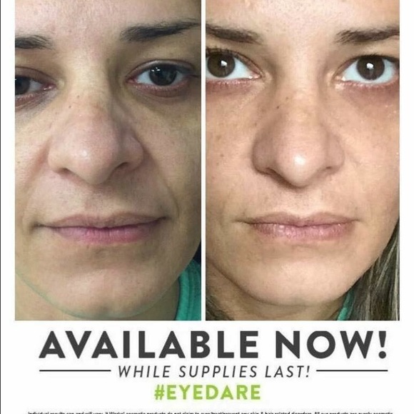 WOW (Wipe Out Wrinkles) - Picture 2 of 4