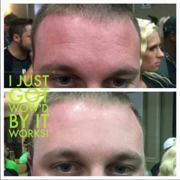 WOW (Wipe Out Wrinkles) - Picture 3 of 4