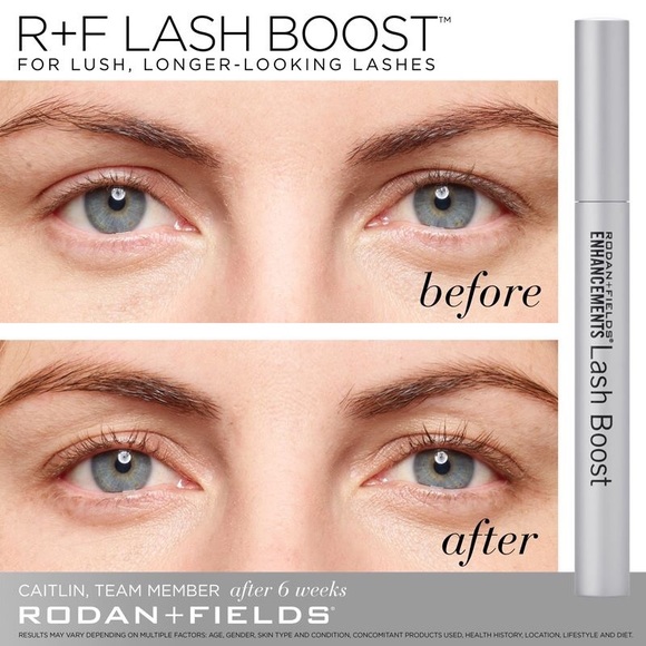 Rodan and Fields - Picture 4 of 4
