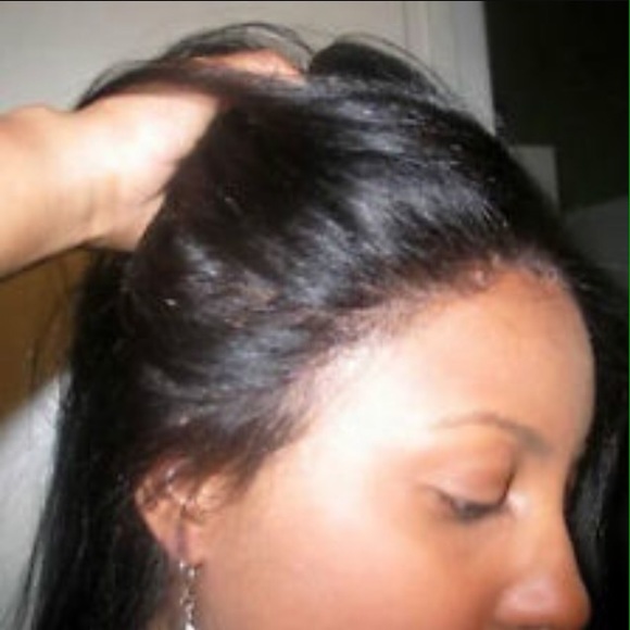 13x4 Virgin closure hairloss? Get A weave Sewn? main image 7