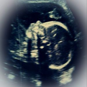 Meet your Posher, Angel