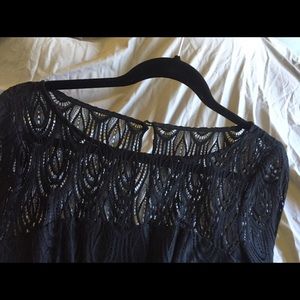 Lilly Pulitzer black scallop lace dress