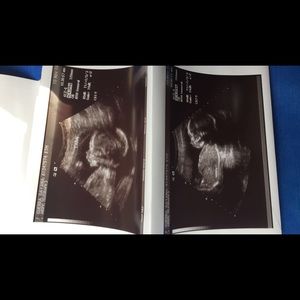 Meet your Posher, Romero