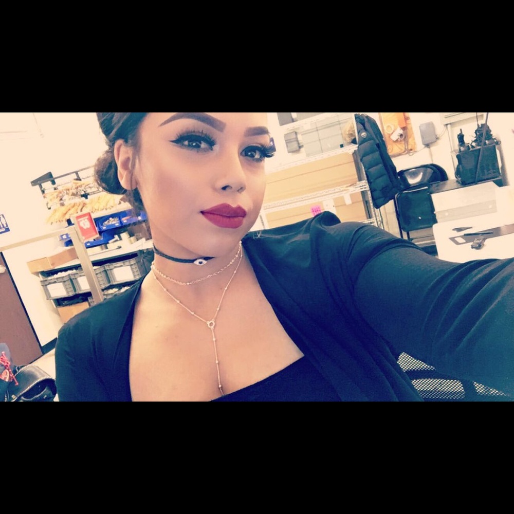 Ig - Picture 1 of 1