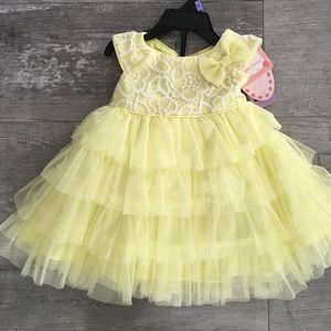 Yellow tulle dress