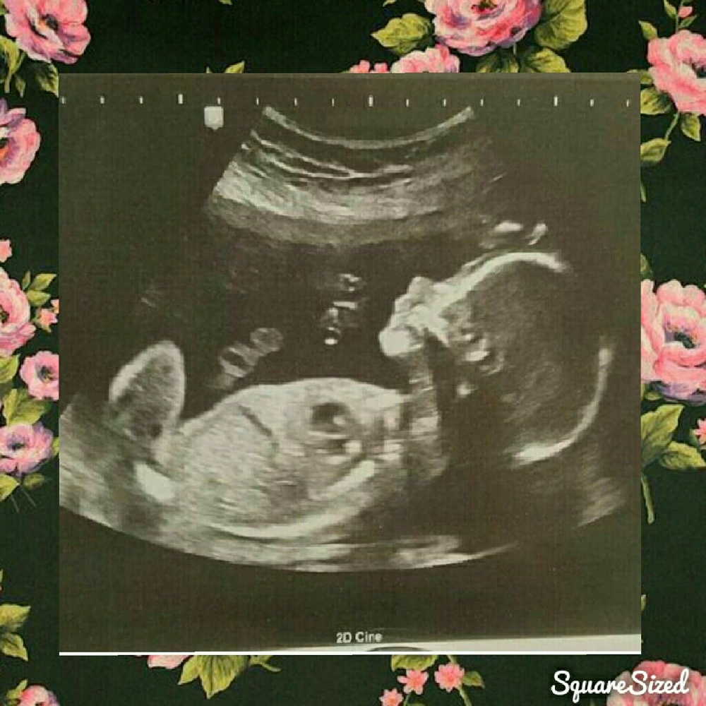 Yayyyyy it's official!!