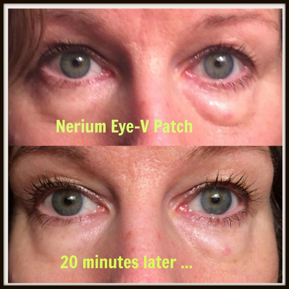 Eye-V™ Moisture Boost Hydrogel Patches. Contact me