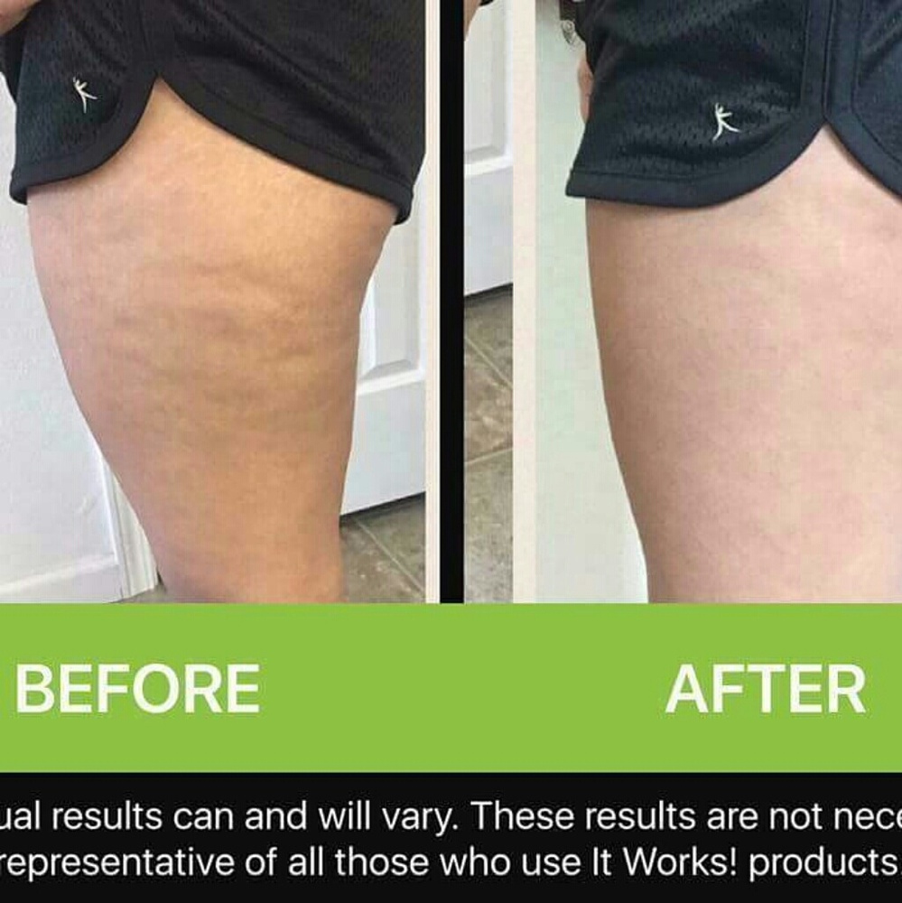 Defining gel