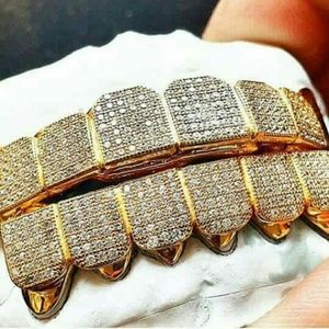 Custom gold grillz and jewelry