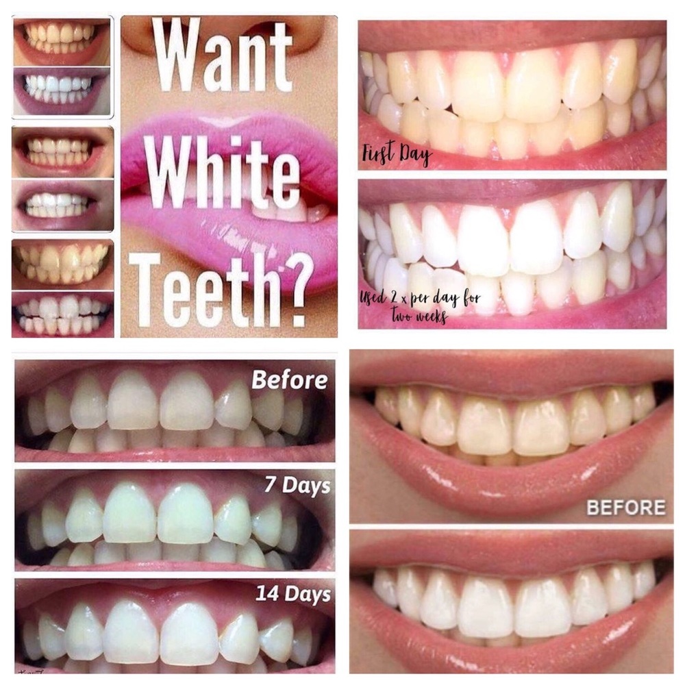 WHITE TEETH! 😬