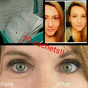 Instantly ageless anti wrinkle cream