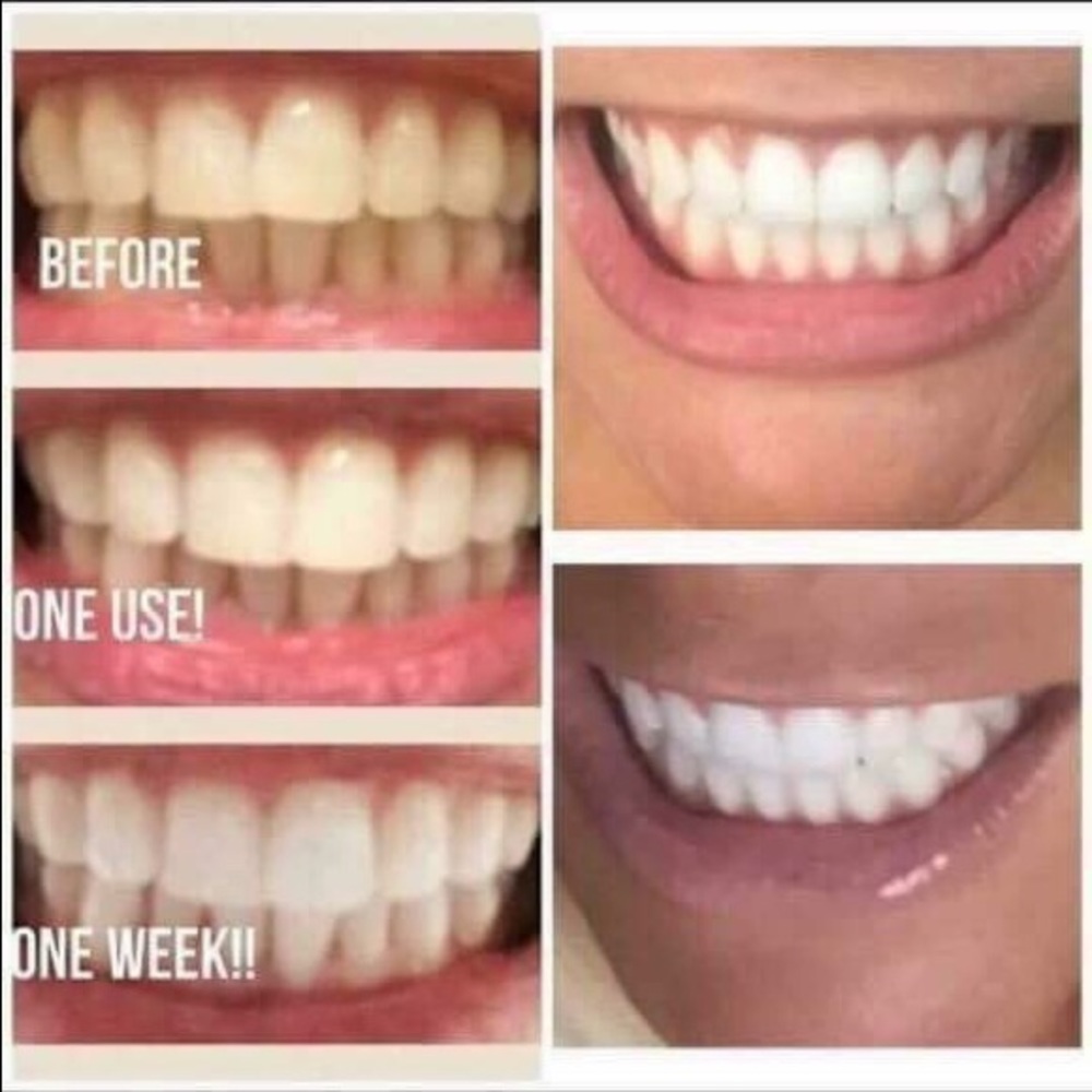 Whitening Fluoride Toothpaste