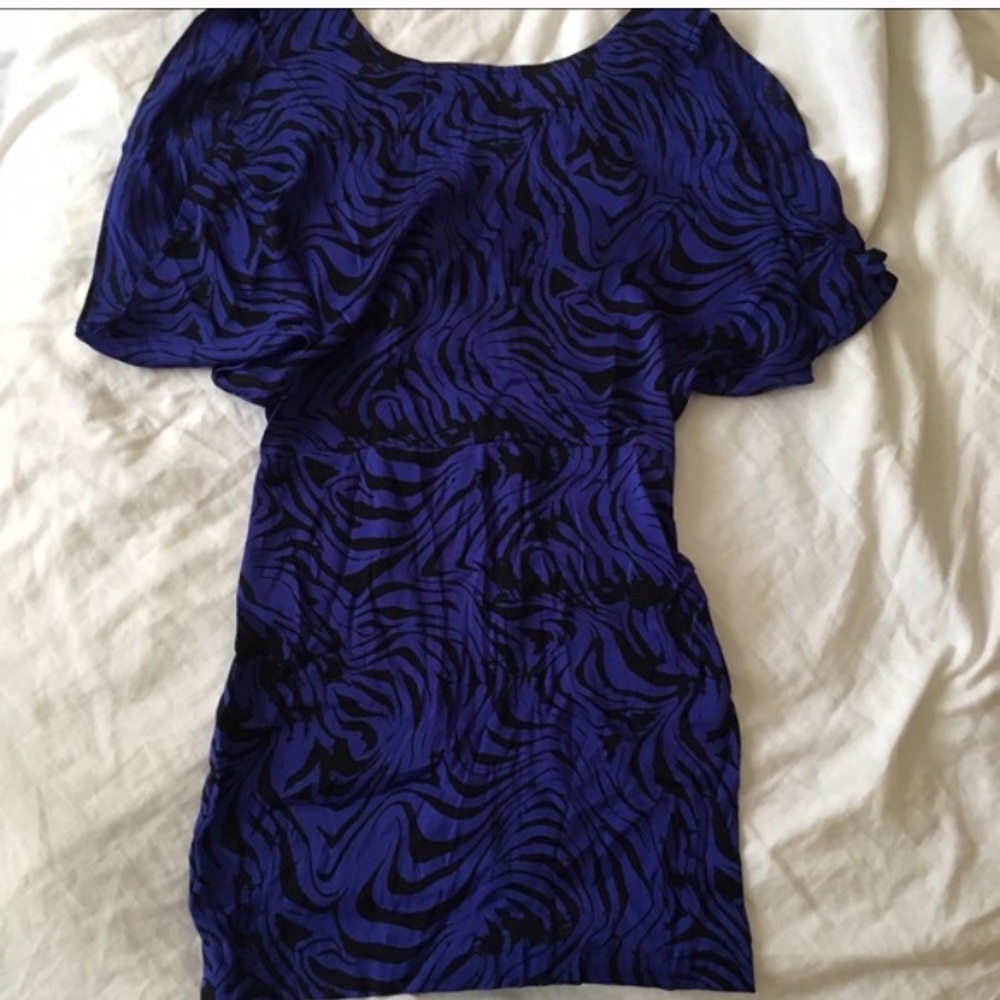 Dolce vita open back dress