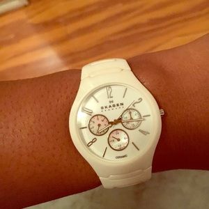 Gorgeous white Skagen watch