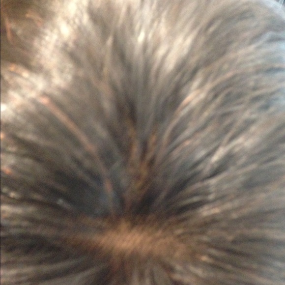Alopecia tritchotillomania Cancer hairloss wigs main image 6