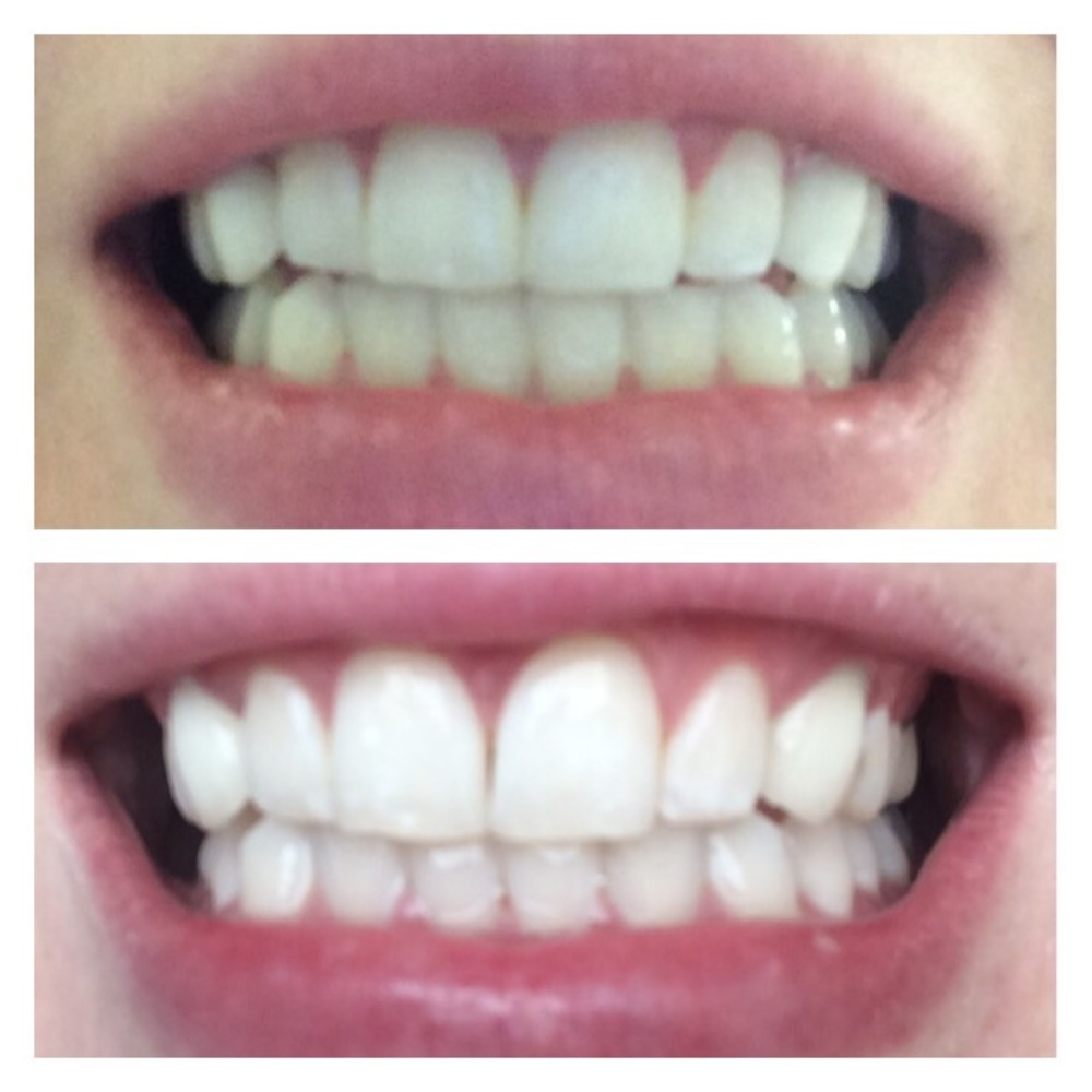 AP-24 toothpaste - Picture 2 of 2