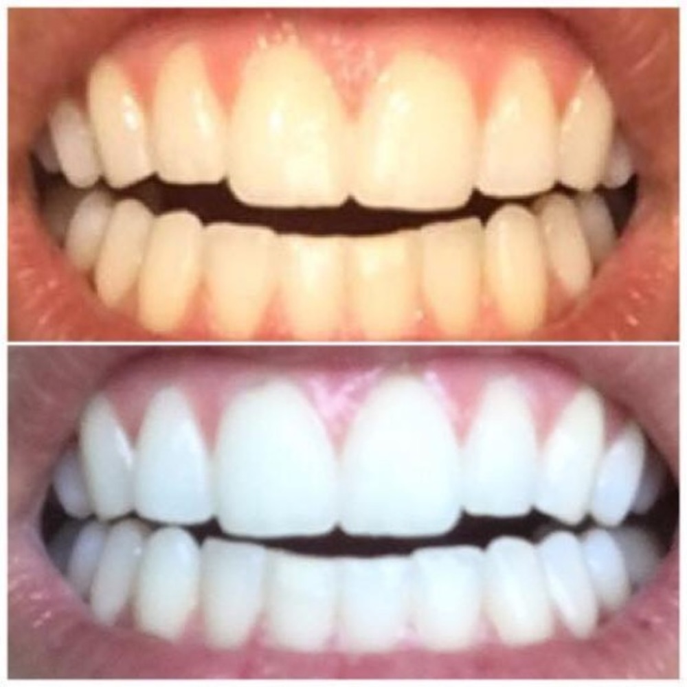 AP-24 toothpaste