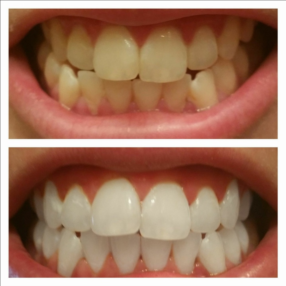 Ap24 Whitening Toothpaste