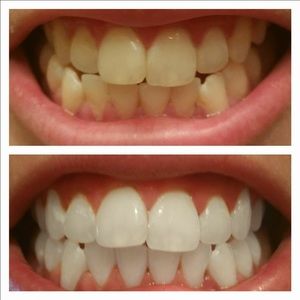 Ap24 Whitening Toothpaste