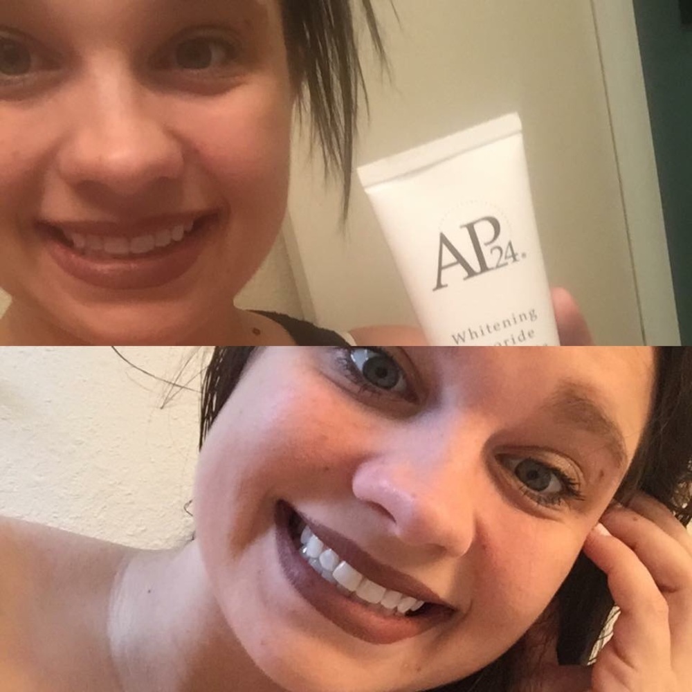 Whitening Toothpaste